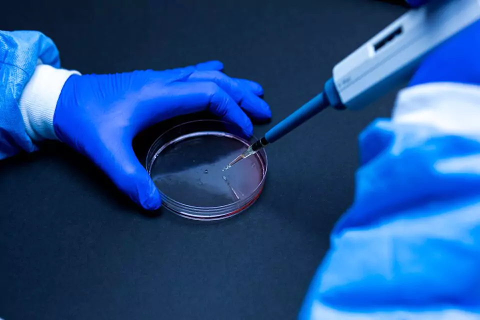 surgical sperm retrieval